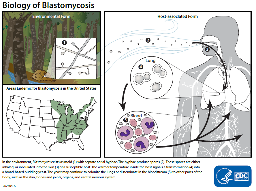 life cycle Blastomyces